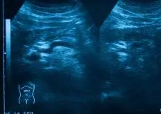 乐竟体育官网 -xcc提取器官网免费版